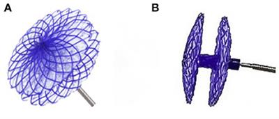 Echocardiographic characteristics of transcatheter closure of patent foramen ovale with mallow biodegradable occluder: A single-center, phase III clinical study